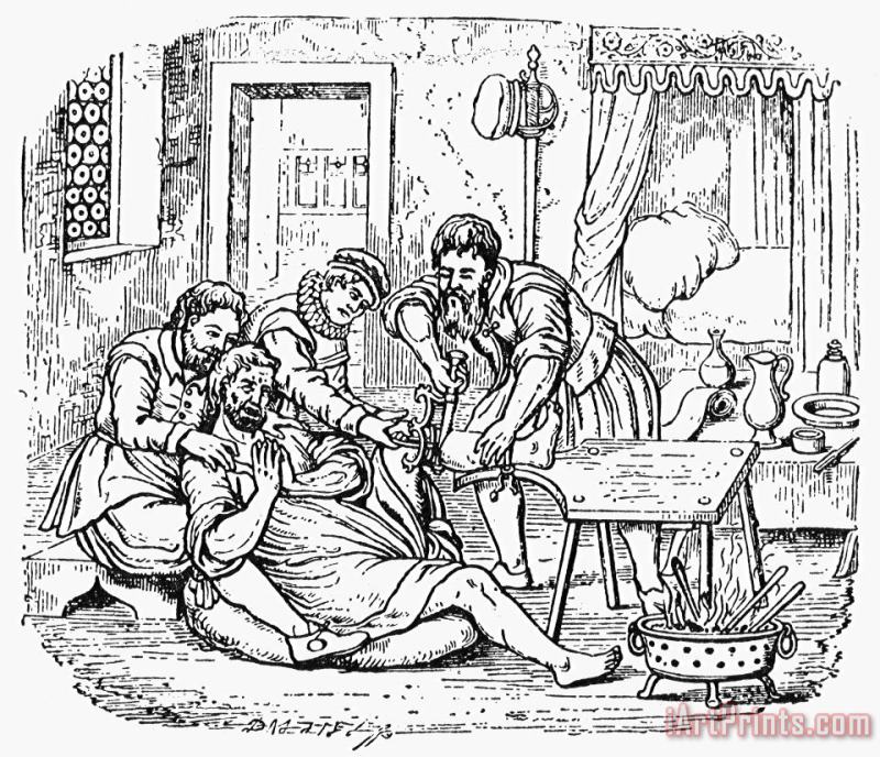 Others Home Amputation, 1592 Art Painting