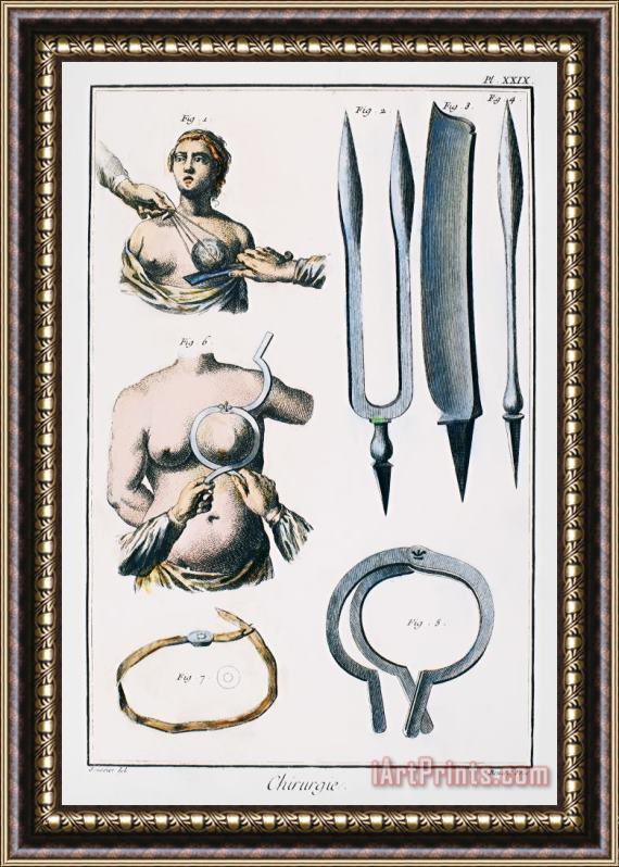 Others Breast Surgery Framed Painting